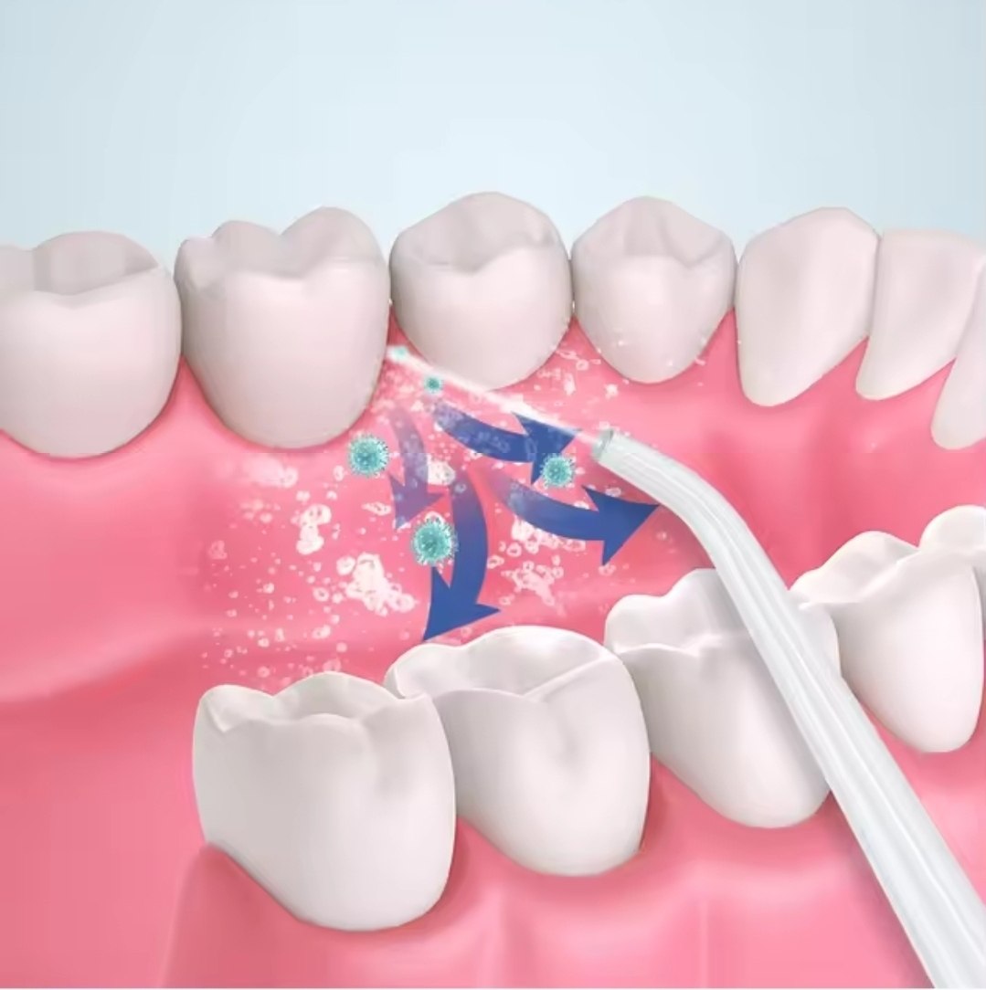 🦷 جهاز  الأسنان المائي الاحترافي – الحل المتكامل لصحة الفم والأسنان